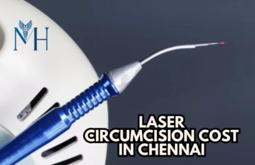 Laser Circumcision Cost in Chennai